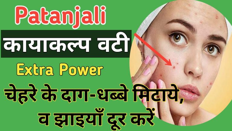 Kayakalp vati Benefits in Hindi