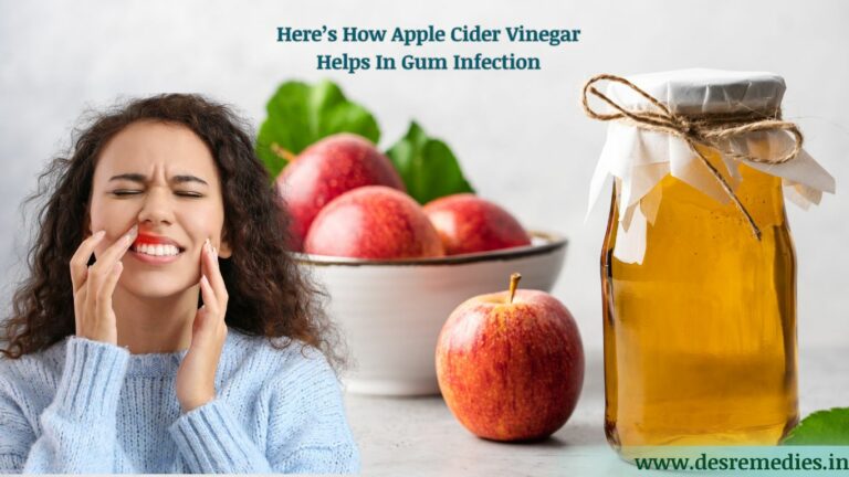 Apple Cider Vinegar for Gum Infection